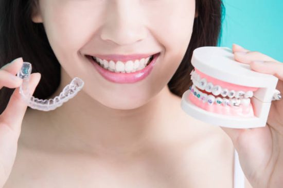 Self-Ligating Ceramic Clear Oral Braces