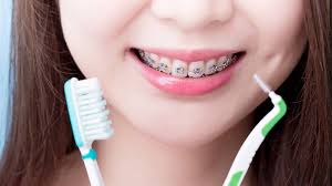 Best Toothbrush for Braces